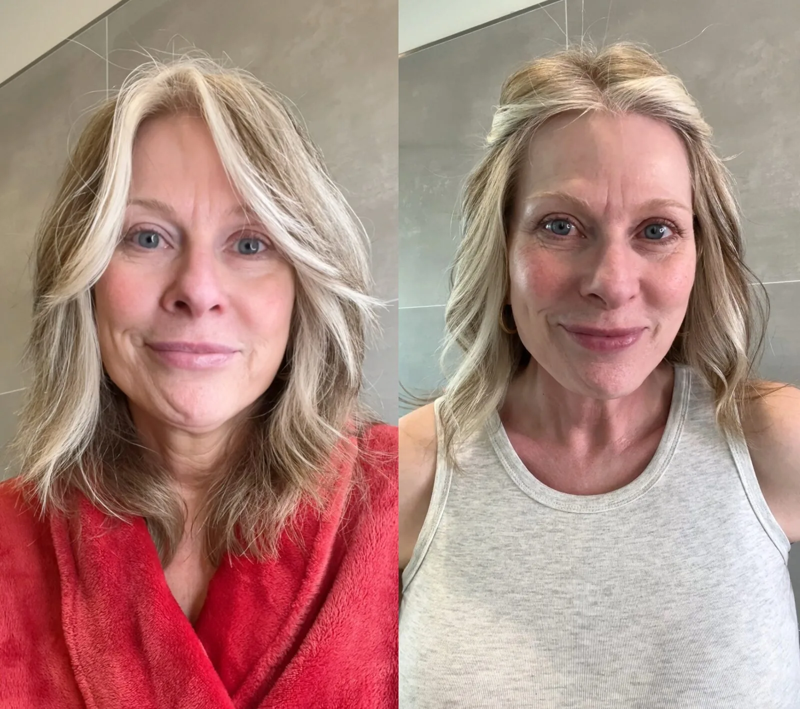 Before and after — Redness calmed & lift