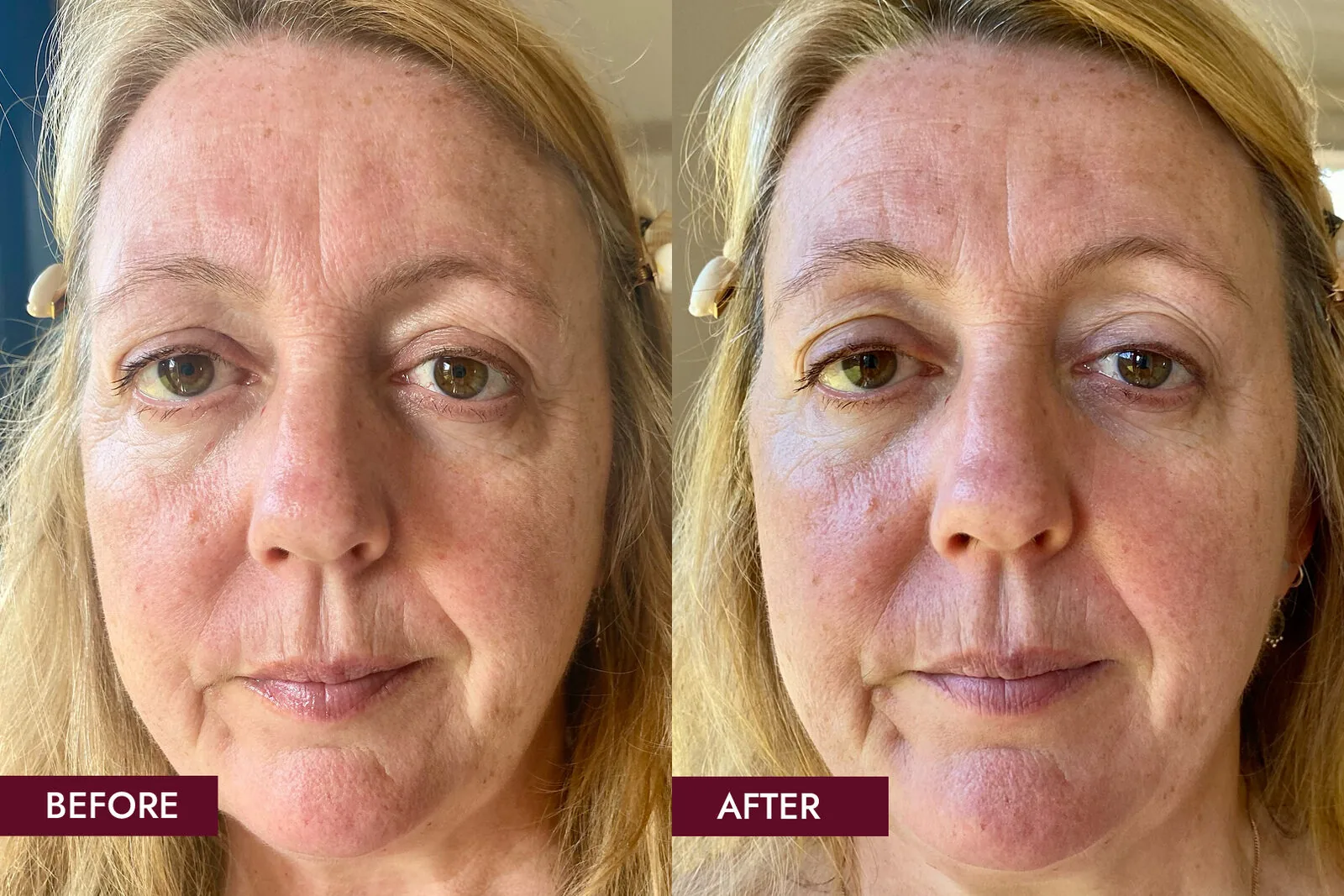Before and after — Smoothness & even tone