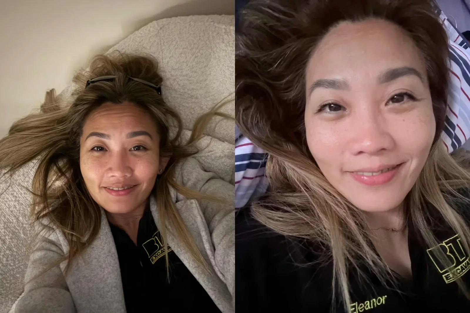 Before and after — Pigmentation & glow