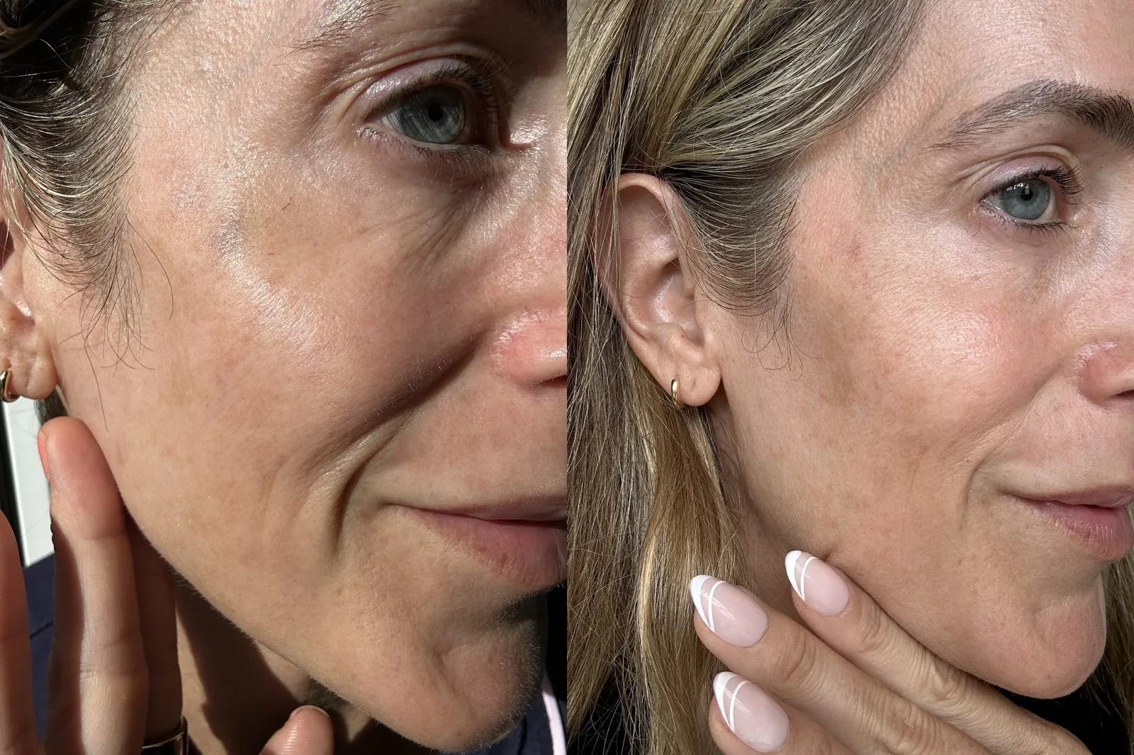 Before and after — Texture & clarity